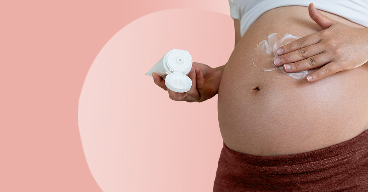 Stretch marks in pregnancy